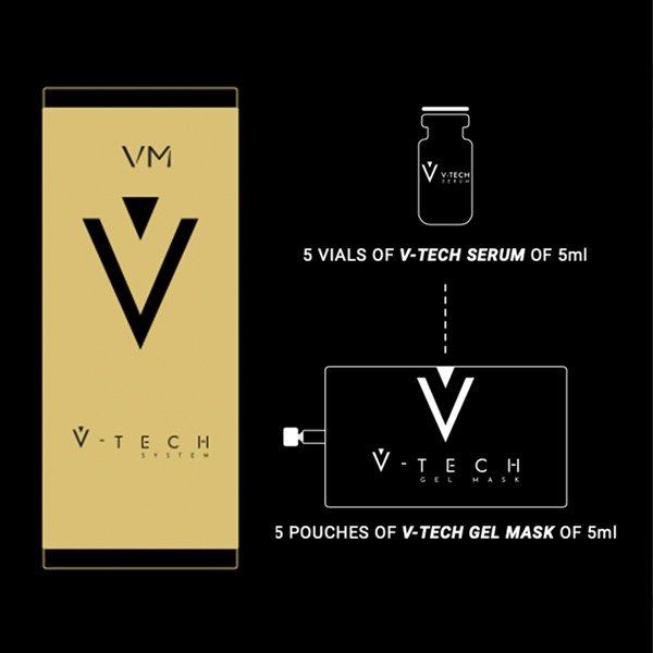 V-Tech System - Image 3